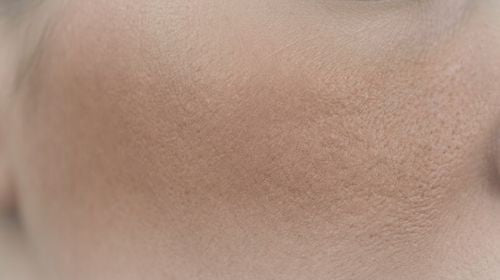 Matte Haut